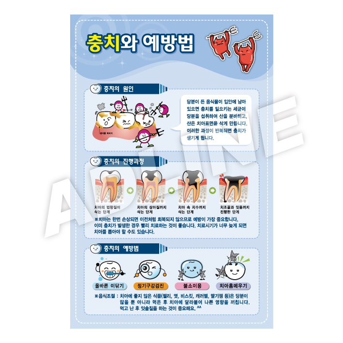 충치와예방법